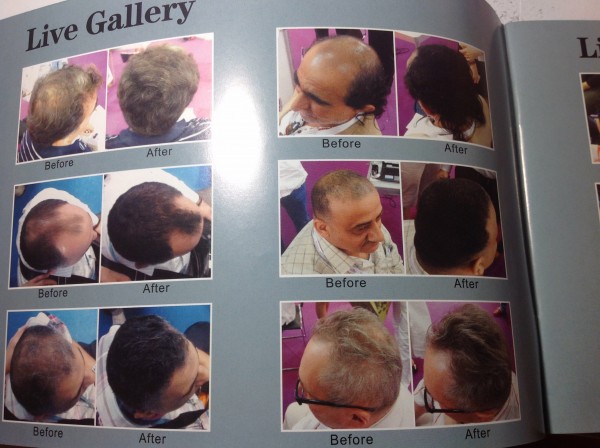 Загустители волос. Сравниваем Toppik, Nanogen, Kmax, HairMax, DeXe_12