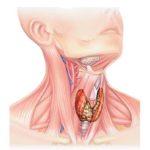 Проблемы с щитовидной железой